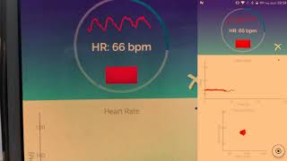Full HRV Camera Usage Update