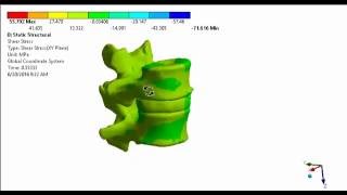 Simulation of a Lumbar Motion Segment by MeHHeY_mehdi heydarzadeh