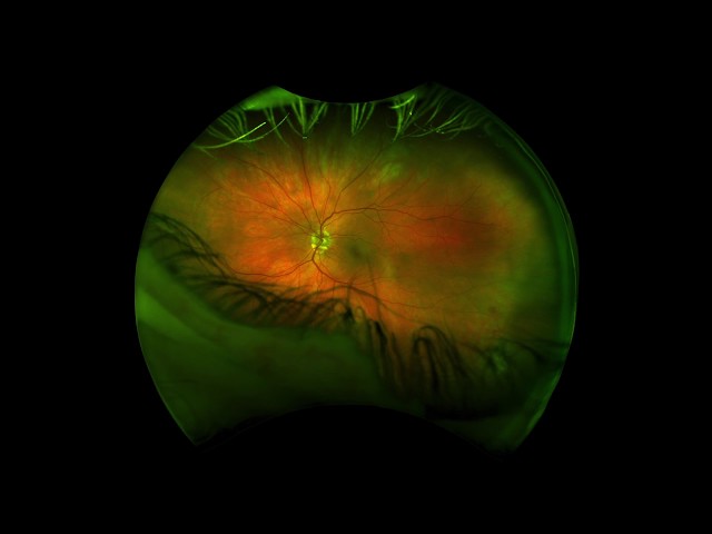 Trimox En El Mostrador