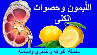 فوائد الليمون لتجنب حصوات الكلى وأسباب حدوث حصى الكلى