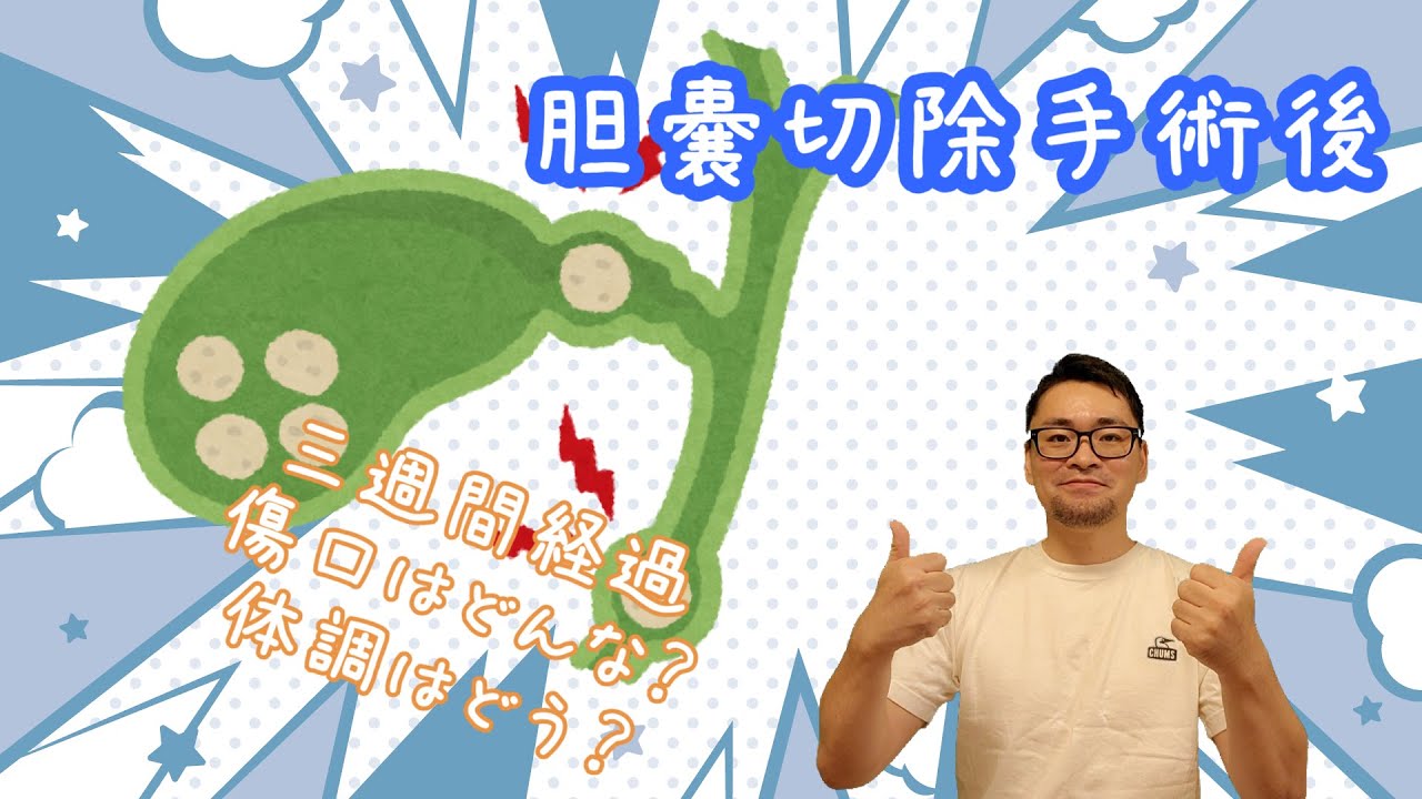 胆嚢切除手術から三週間経過 現在の傷の状態と体調 YouTube
