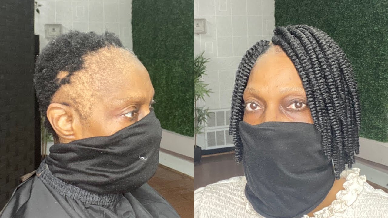 She wanted to conceal her alopecia with a natural hairstyle.