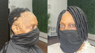 She wanted to conceal her alopecia with a natural hairstyle. She wanted to conceal her alopecia with a natural hairstyle.