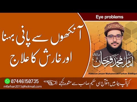 Eye Problems... آنکھوں سے پانی بہنا اور خارش  کا علاج