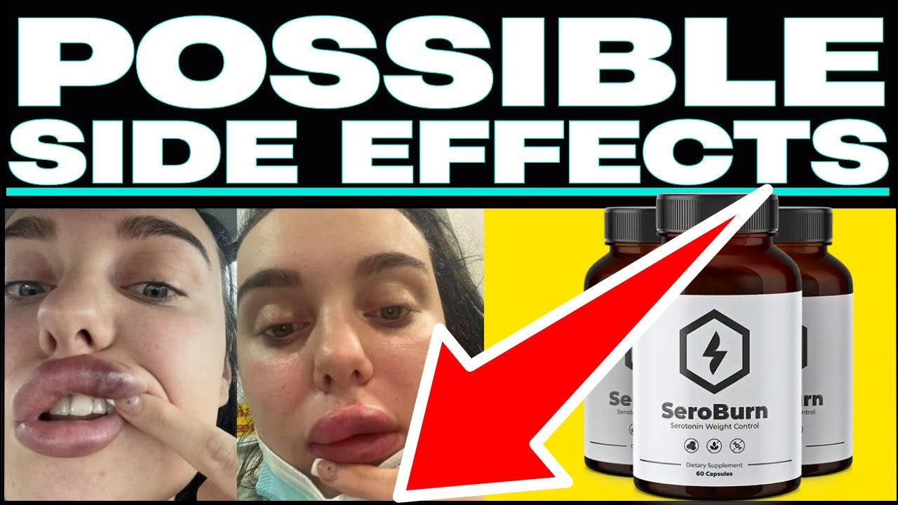 Lose weight fast? (😱❌BEWARE⛔🙀) Get Your FREE Bottle Of SeroBurn? @SeroBurn #seroburncom #seroburn