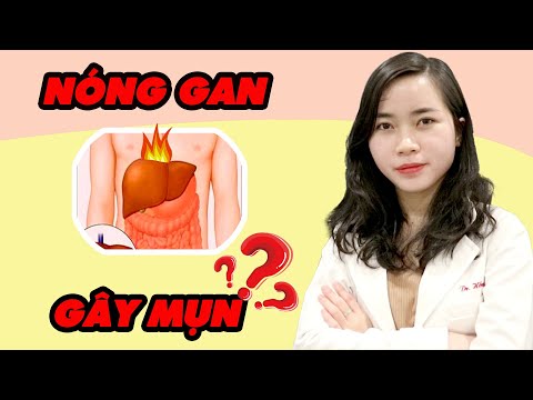 Cách Trị Mụn Nóng Trên Mặt - Tiết lộ sự thật NÓNG GAN gây MỤN? Lầm tưởng về "nóng gan" và mụn? | Bác sĩ Nguyễn Ngọc