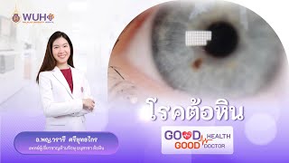 Good health Good doctor ตอนที่ 14 : โรคต้อหิน