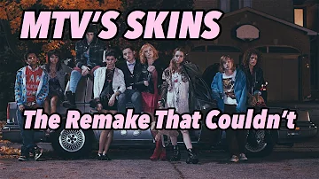 Is there a Skins US version?