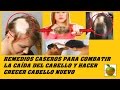 SE TE CAE EL CABELLO? AQUÍ ESTÁN LAS SOLUCIONES - S DE SALUD