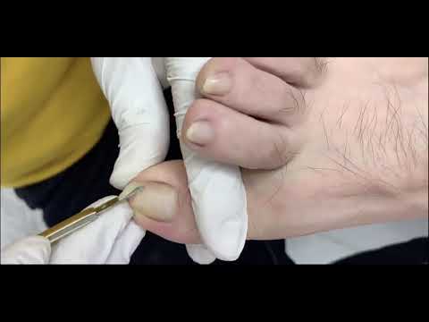 修修甲,不看不知道,一看吓一跳