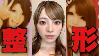 整形してますか？について。