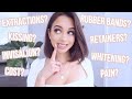 BRACES Q&A | ANSWERING ALL YOUR BRACES QUESTIONS