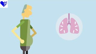 6 Myths About COPD | Healthgrades