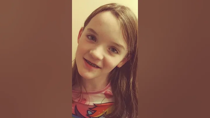 She lost her teeth