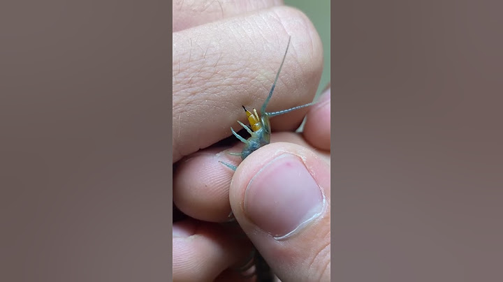 Tiger Centipede Bite