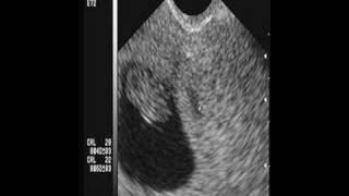 Dr Galo Farfán - Cirujano gineco-obstetra
De Guayaquil, Ecuador Dr Galo Farfán - Cirujano gineco-obstetra