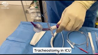 Percutaneous tracheostomy