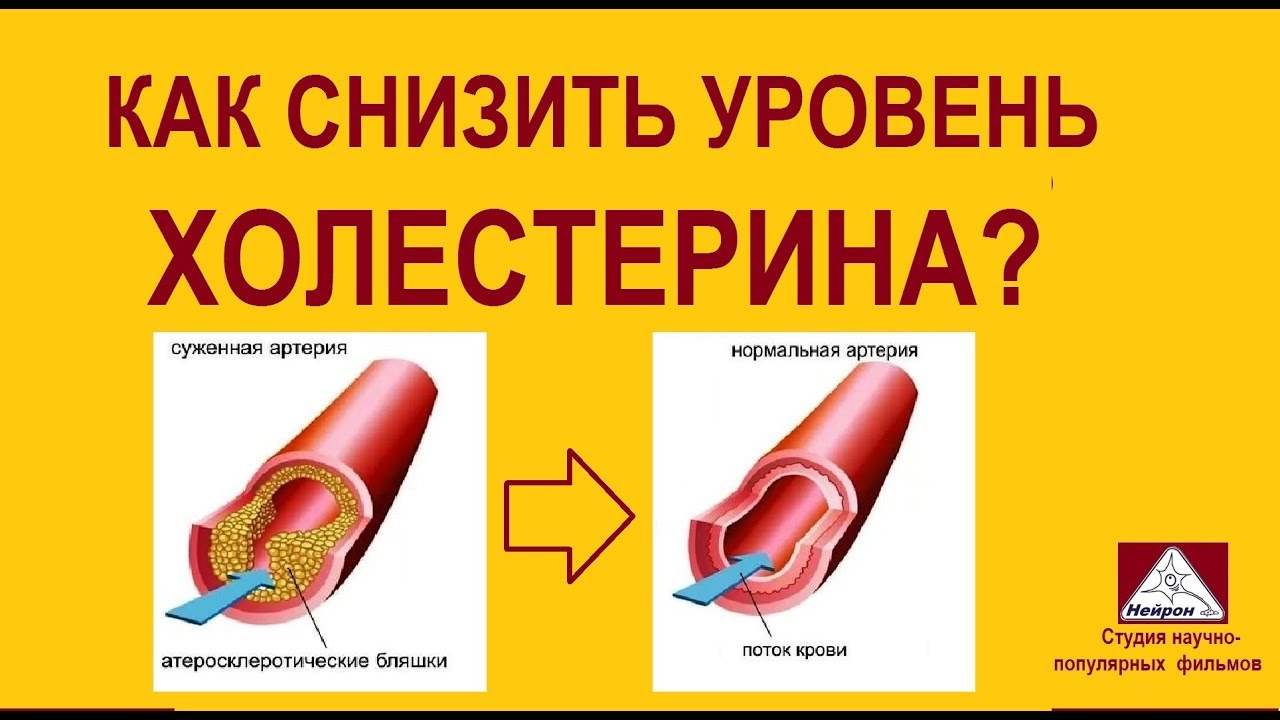 Понижение холестерина. Снижение уровня холестерина в крови. Как понизить холестерин. Снизить холестер. Как понизить холестерин в крови.