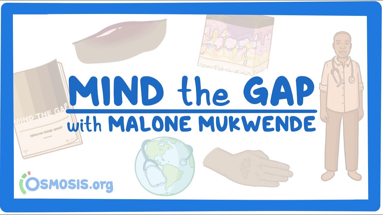 Mind the Gap with Malone Mukwende - YouTube