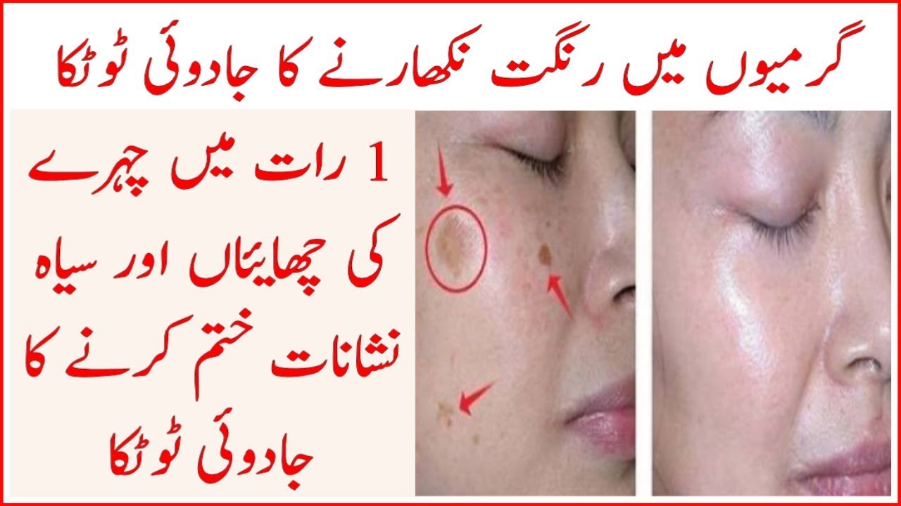 Magically Remove Dark spots From Face Overnight || Home Remedy for Skin Lightening Fast