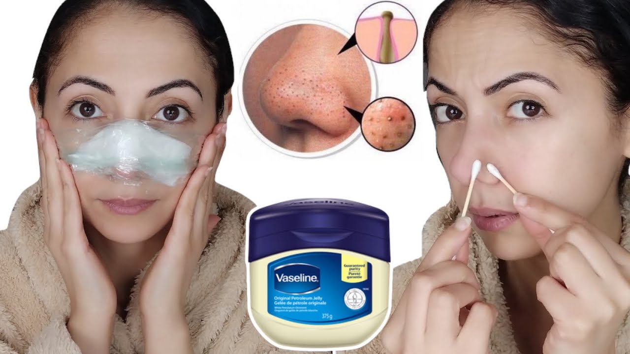 Comment utiliser la vaseline pour enlever les tâches du visage