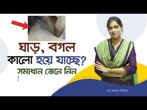 ভিডিও: এটি কি সহ-সম্পাদনা করা হয়?