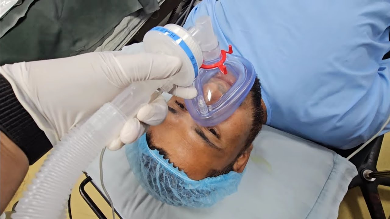 Young man under going for neurosurgery#anesthesia #plid #induction #intubation 