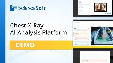 Chest X-Ray AI Analysis Platform | Demo Tour
