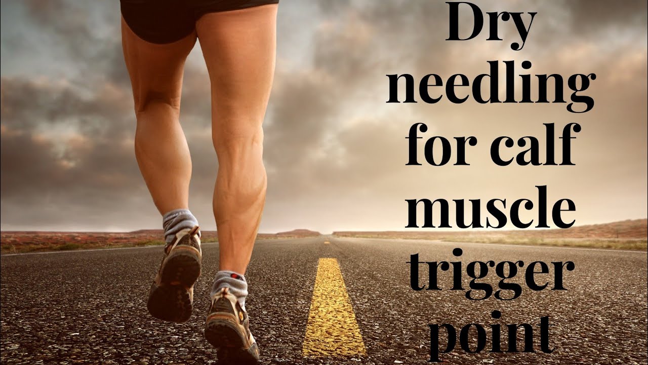 Dry needling for calf muscle trigger point YouTube