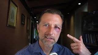 Thumbnail for This SUCKS! - Dr. Berg
