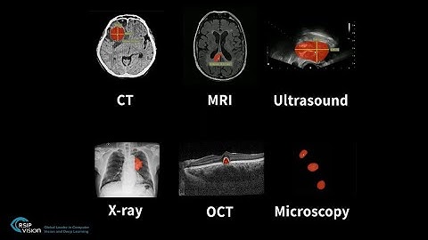 One-click segmentation in medical imaging - by RSIP Vision