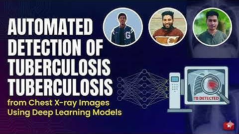 Automated Detection of Tuberculosis from Chest X-ray Images Using Deep Learning Models || PUC