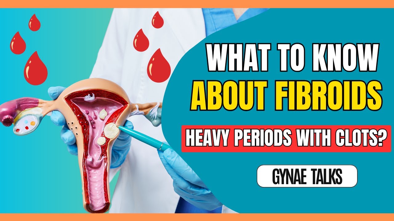 Understanding Fibroids | Gyna Talks