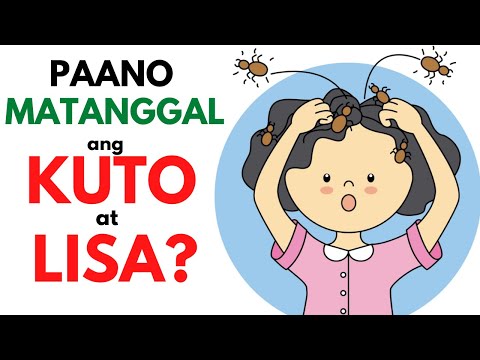 Video: Paano Magagamot ang Mga Kuto sa Ulo na may suka: 8 Hakbang (na may Mga Larawan)