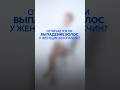 Отличается ли выпадение волос у женщин и мужчин?