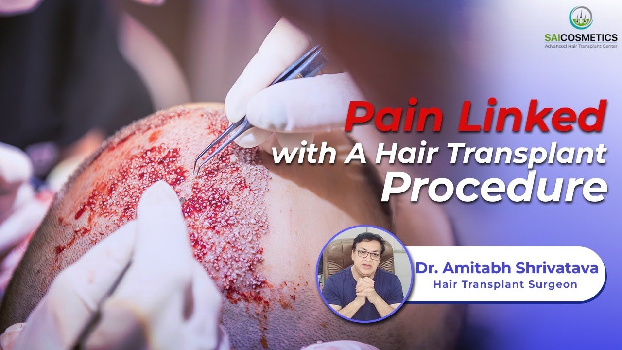 #hairtransplantpune Pain Linked With A Hair Transplant Procedure. #affordablehairtransplant