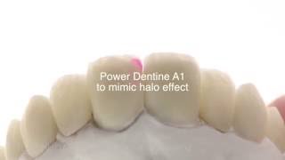 e max basic micro layering
