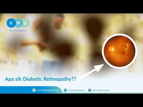 Video: Dokter Diabetes: Dokter Mata, Podiatris, Ahli Diet, Dan Lainnya