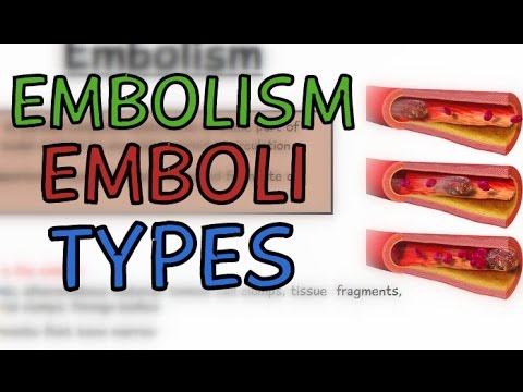 Video: Emboli - Fett, Luft, Lungor, Gas Och Emboli I Artärer Och Kärl
