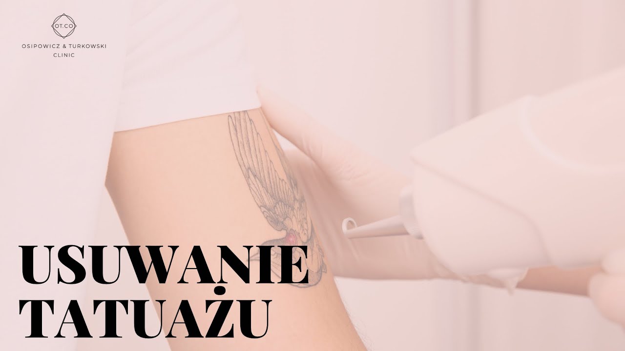 Usuwanie tatuażu laserem pikosekundowym