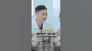 Mất răng lâu ngày không trồng lại thì sẽ ra sao? | Lạc Việt Intech Implant #lvnw #short
