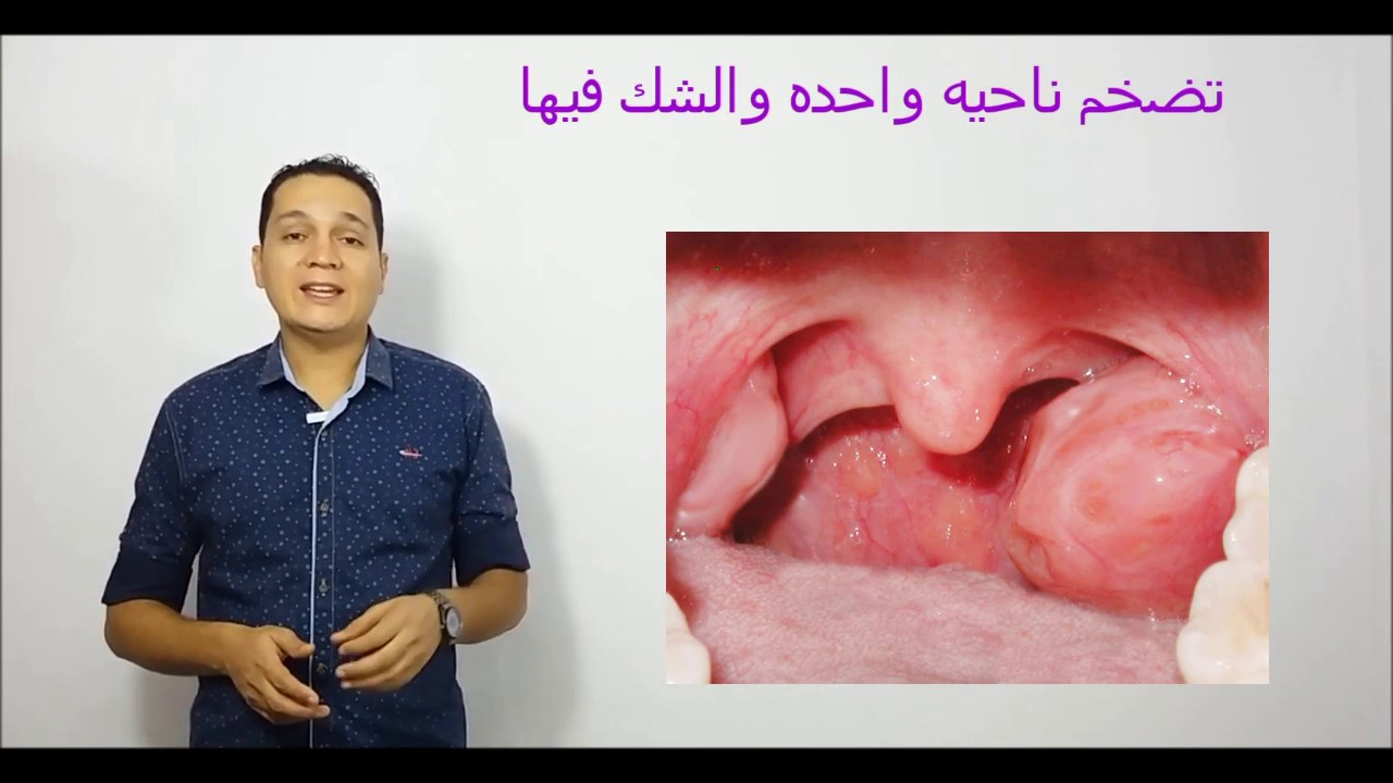 امتى تشيل اللوز لابنك ؟