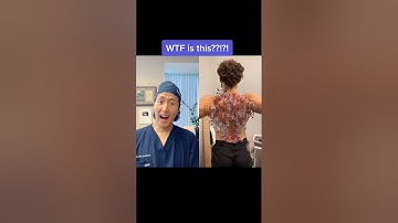 Extreme Cupping Therapy! #shorts #cupping