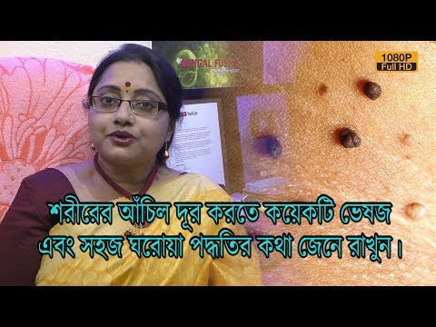 ভিডিও: খোসা কিভাবে মেরে ফেলা যায়: ঘরোয়া প্রতিকার কি সাহায্য করতে পারে?