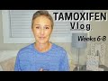 How I FEEL after 2 Months on TAMOXIFEN | Breast Cancer Survivor | Tamoxifen Vlog