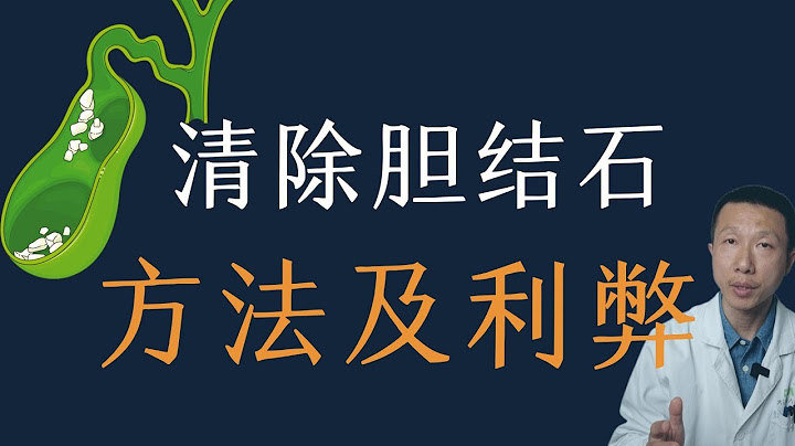 如何去除胆囊结石？风险利弊分析 - 天天要闻