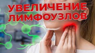 Почему увеличиваются ЛИМФОУЗЛЫ! Лимфоденопатия. Как оценить лимфоузлы самостоятельно.