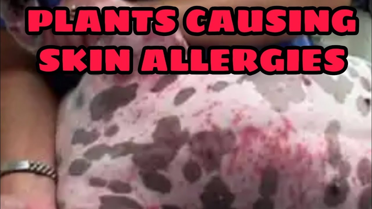 Plants causing skin allergies to your dogs in tamil skin