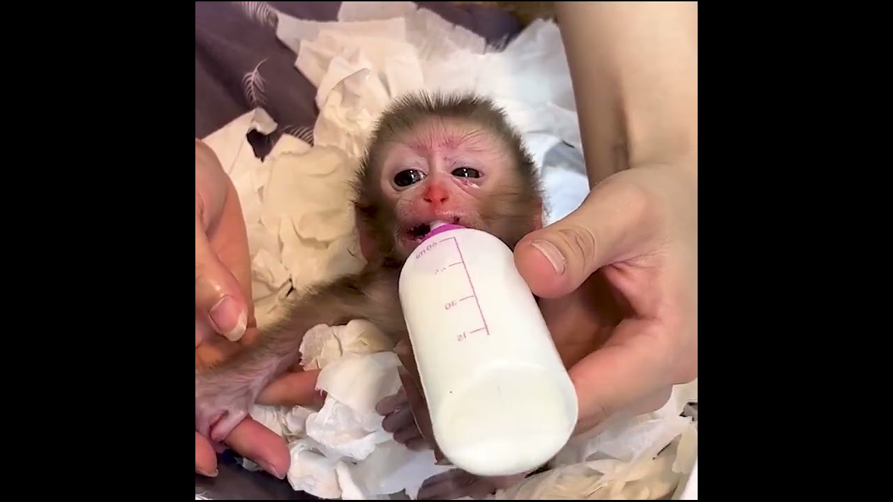 Poor Baby Junio has a rash on his eyes.