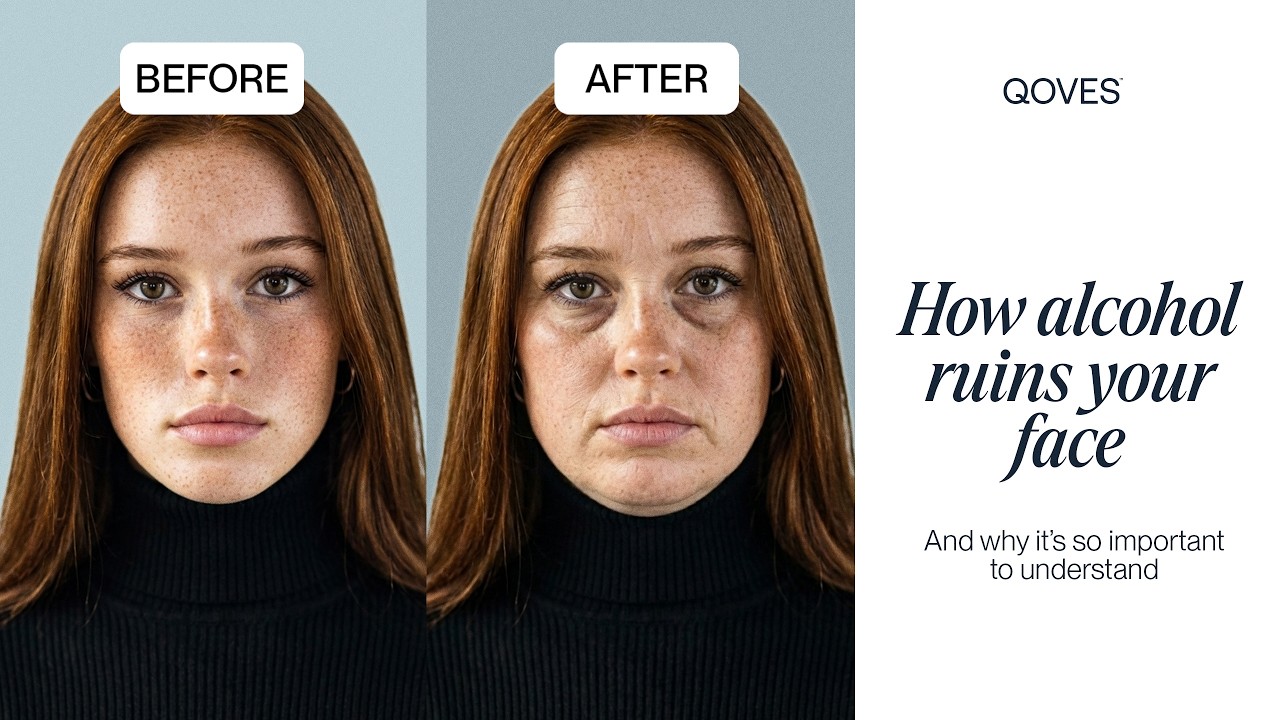 How Alcohol RUINS Your Face! - YouTube
